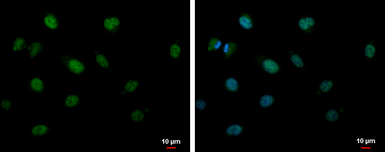 Anti-CIRBP antibody [N1C3] used in Immunocytochemistry/ Immunofluorescence (ICC/IF). GTX120184