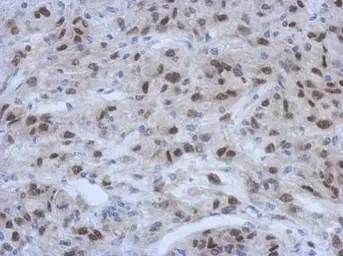 Anti-CIRBP antibody [N1C3] used in IHC (Paraffin sections) (IHC-P). GTX120184