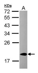 Anti-CIRBP antibody [N1C3] used in Western Blot (WB). GTX120184