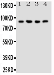Anti-NRG2 antibody used in Western Blot (WB). GTX12019
