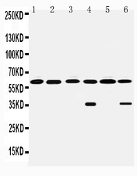 Anti-Monoamine Oxidase B antibody used in Western Blot (WB). GTX12021