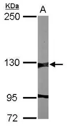 Anti-G9a antibody [C1C2], Internal used in Western Blot (WB). GTX120210