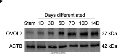 Anti-OVOL2 antibody used in Western Blot (WB). GTX120220