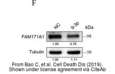 Anti-FAM171A1 antibody [C1C3] used in Western Blot (WB). GTX120226