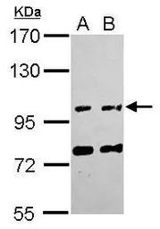 Anti-FAM171A1 antibody [C1C3] used in Western Blot (WB). GTX120226