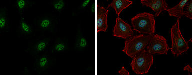 Anti-RBM26 antibody [C1C2], Internal used in Immunocytochemistry/ Immunofluorescence (ICC/IF). GTX120227