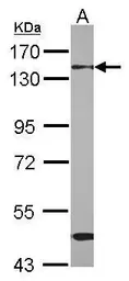 Anti-RBM26 antibody [C1C2], Internal used in Western Blot (WB). GTX120227