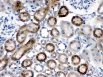 Anti-NOX1 antibody used in IHC (Paraffin sections) (IHC-P). GTX12023