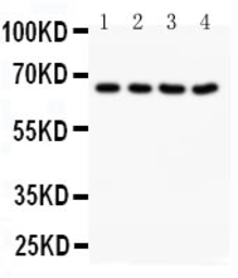 Anti-NOX1 antibody used in Western Blot (WB). GTX12023