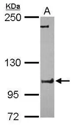 Anti-FCHO1 antibody [C1C3] used in Western Blot (WB). GTX120231