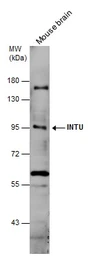 Anti-INTU antibody used in Western Blot (WB). GTX120239