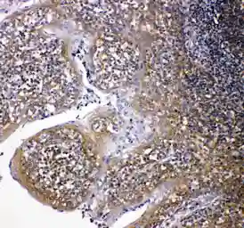 Anti-NOX2 / gp91phox antibody used in IHC (Paraffin sections) (IHC-P). GTX12024