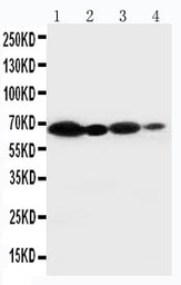 Anti-NOX2 / gp91phox antibody used in Western Blot (WB). GTX12024