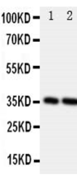Anti-Podoplanin antibody used in Western Blot (WB). GTX12025