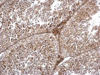 Anti-TRAPPC2L antibody used in IHC (Paraffin sections) (IHC-P). GTX120259