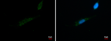 Anti-MRPL42 antibody used in Immunocytochemistry/ Immunofluorescence (ICC/IF). GTX120260
