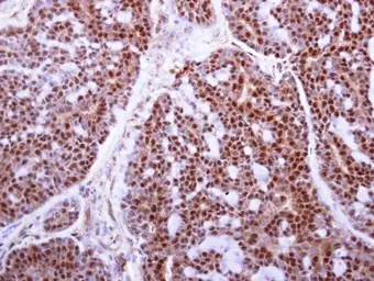 Anti-MAFF antibody used in IHC (Paraffin sections) (IHC-P). GTX120264