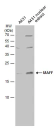Anti-MAFF antibody used in Western Blot (WB). GTX120264