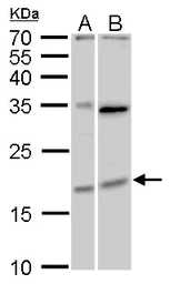 Anti-MAFF antibody used in Western Blot (WB). GTX120264