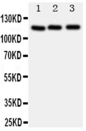 Anti-MYPT1 antibody used in Western Blot (WB). GTX12027