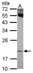 Anti-ANKRD39 antibody [N1C3] used in Western Blot (WB). GTX120277