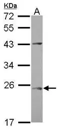Anti-C1orf146 antibody [N1C3] used in Western Blot (WB). GTX120280
