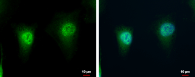 Anti-LZIC antibody used in Immunocytochemistry/ Immunofluorescence (ICC/IF). GTX120288