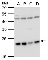 Anti-LZIC antibody used in Western Blot (WB). GTX120288