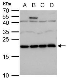 Anti-LZIC antibody used in Western Blot (WB). GTX120288