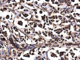 Anti-WDYHV1 antibody used in IHC (Paraffin sections) (IHC-P). GTX120298