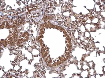 Anti-WDYHV1 antibody used in IHC (Paraffin sections) (IHC-P). GTX120298