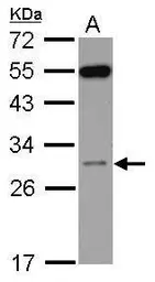 Anti-RPS8 antibody [N1C3] used in Western Blot (WB). GTX120300