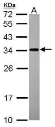 Anti-Nop25 antibody used in Western Blot (WB). GTX120303