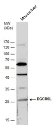 Anti-DGCR6L antibody used in Western Blot (WB). GTX120306