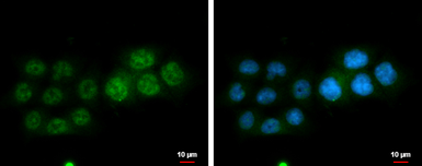 Anti-DGCR6L antibody used in Immunocytochemistry/ Immunofluorescence (ICC/IF). GTX120306