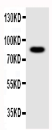 Anti-NLRP4G antibody used in Western Blot (WB). GTX12032