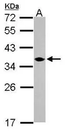 Anti-C1orf74 antibody [N2C3] used in Western Blot (WB). GTX120342