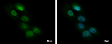 Anti-FAM44A antibody used in Immunocytochemistry/ Immunofluorescence (ICC/IF). GTX120356