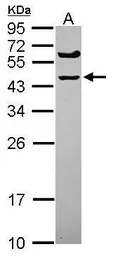 Anti-SPRYD5 antibody [C1C3] used in Western Blot (WB). GTX120369