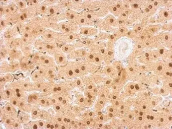 Anti-UPRT antibody used in IHC (Paraffin sections) (IHC-P). GTX120370