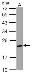 Anti-UPRT antibody used in Western Blot (WB). GTX120370