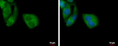 Anti-TOMM40L antibody used in Immunocytochemistry/ Immunofluorescence (ICC/IF). GTX120372