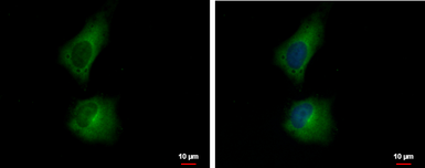Anti-FLJ11506 antibody used in Immunocytochemistry/ Immunofluorescence (ICC/IF). GTX120374