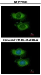 Anti-NARG1L antibody [N1N2], N-term used in Immunocytochemistry/ Immunofluorescence (ICC/IF). GTX120389