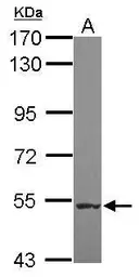 Anti-NARG1L antibody [N1N2], N-term used in Western Blot (WB). GTX120389