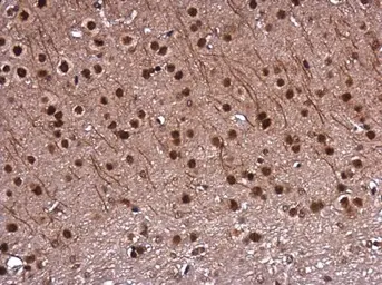 Anti-DNTTIP1 antibody used in IHC (Paraffin sections) (IHC-P). GTX120392