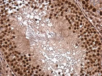 Anti-DNTTIP1 antibody used in IHC (Paraffin sections) (IHC-P). GTX120392