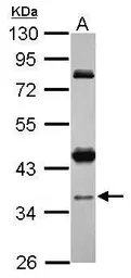 Anti-CCDC94 antibody [N2C3] used in Western Blot (WB). GTX120394