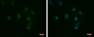 Anti-LCMT1 antibody used in Immunocytochemistry/ Immunofluorescence (ICC/IF). GTX120404