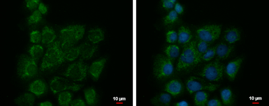 Anti-BZW1 antibody used in Immunocytochemistry/ Immunofluorescence (ICC/IF). GTX120426